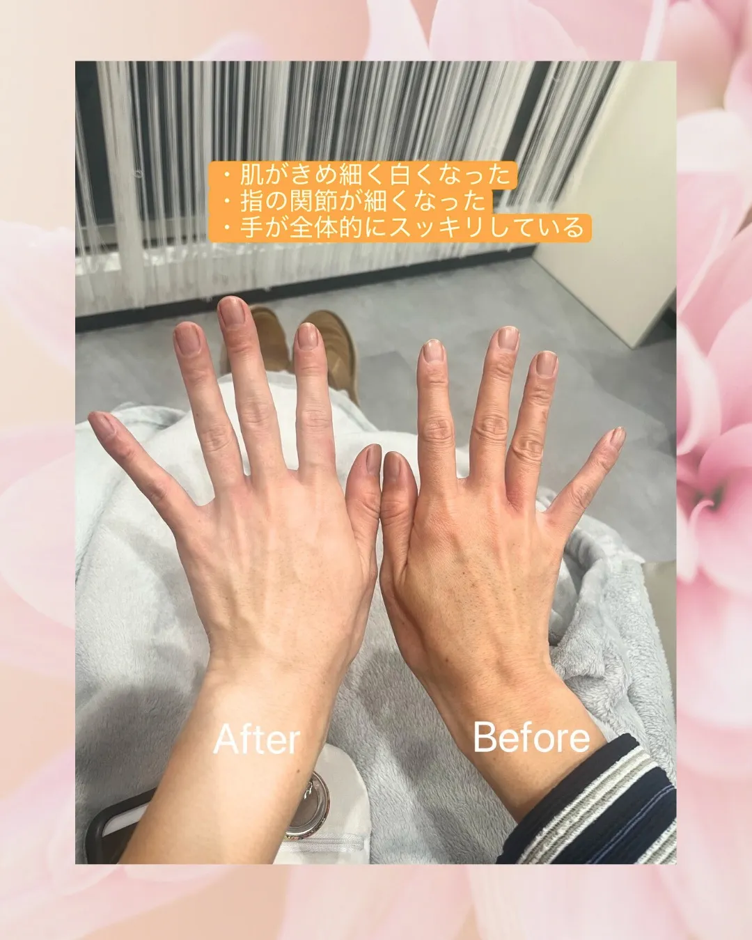 脳疲労の改善と脳の病気の予防・改善に効果的な、指先・手のマッ...